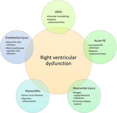 Cardiopulmonary disease as sequelae of long-term COVID-19: Current perspectives and challenges